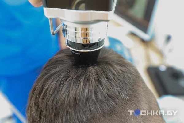 Как белорусы пересаживают волосы Как белорусы пересаживают волосы