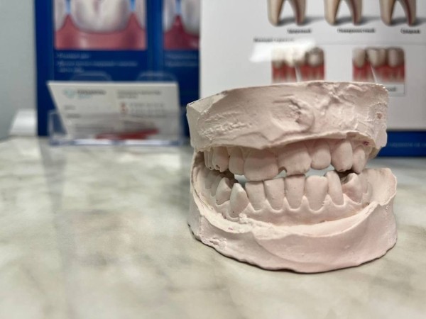 Потратил на зубы $15 тысяч — это того стоило? Белорусы, которые решились на брекеты во взрослом возрасте Потратил на зубы $15 тысяч — это того стоило? Белорусы, которые решились на брекеты во взрослом возрасте