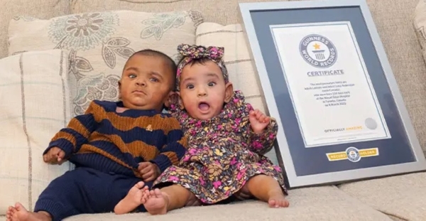 «Шанс на выживание — 0%». Эти близнецы считаются самыми недоношенными в мире «Шанс на выживание — 0%». Эти близнецы считаются самыми недоношенными в мире